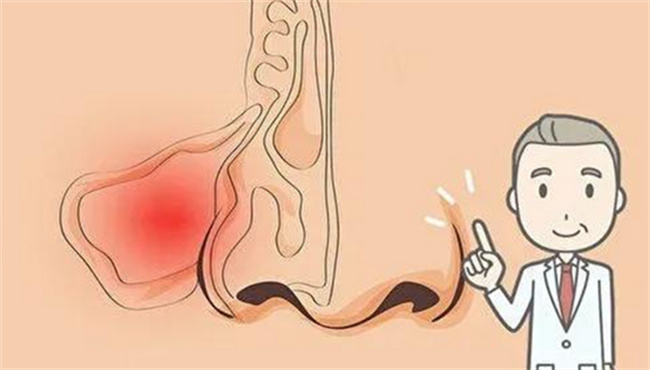 挖鼻孔会造成颅内感染么